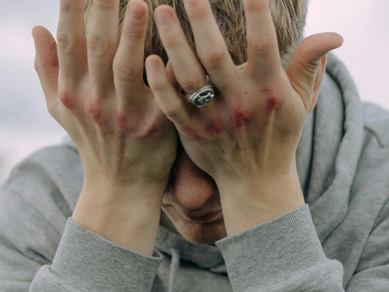 Personne au visage caché derrière ses mains